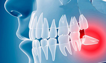 Orthodontic treatment Ahmedabad