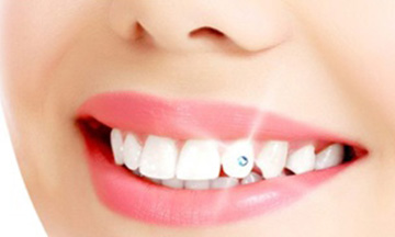 Sensitive teeth treatment Ahmedabad