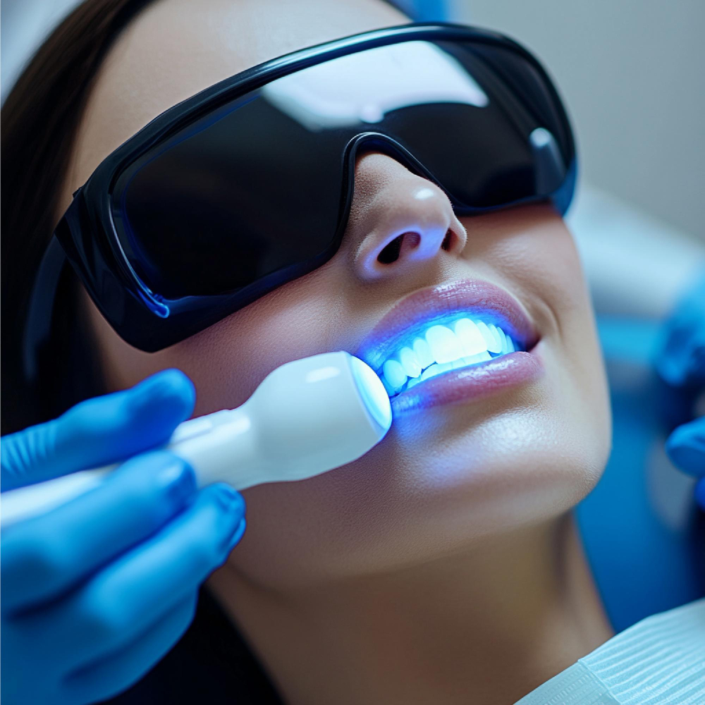 professional teeth whitening in Ahmedabad