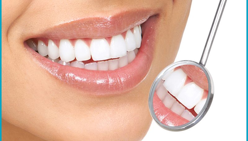 Best Dental Implants in Ahmedabad